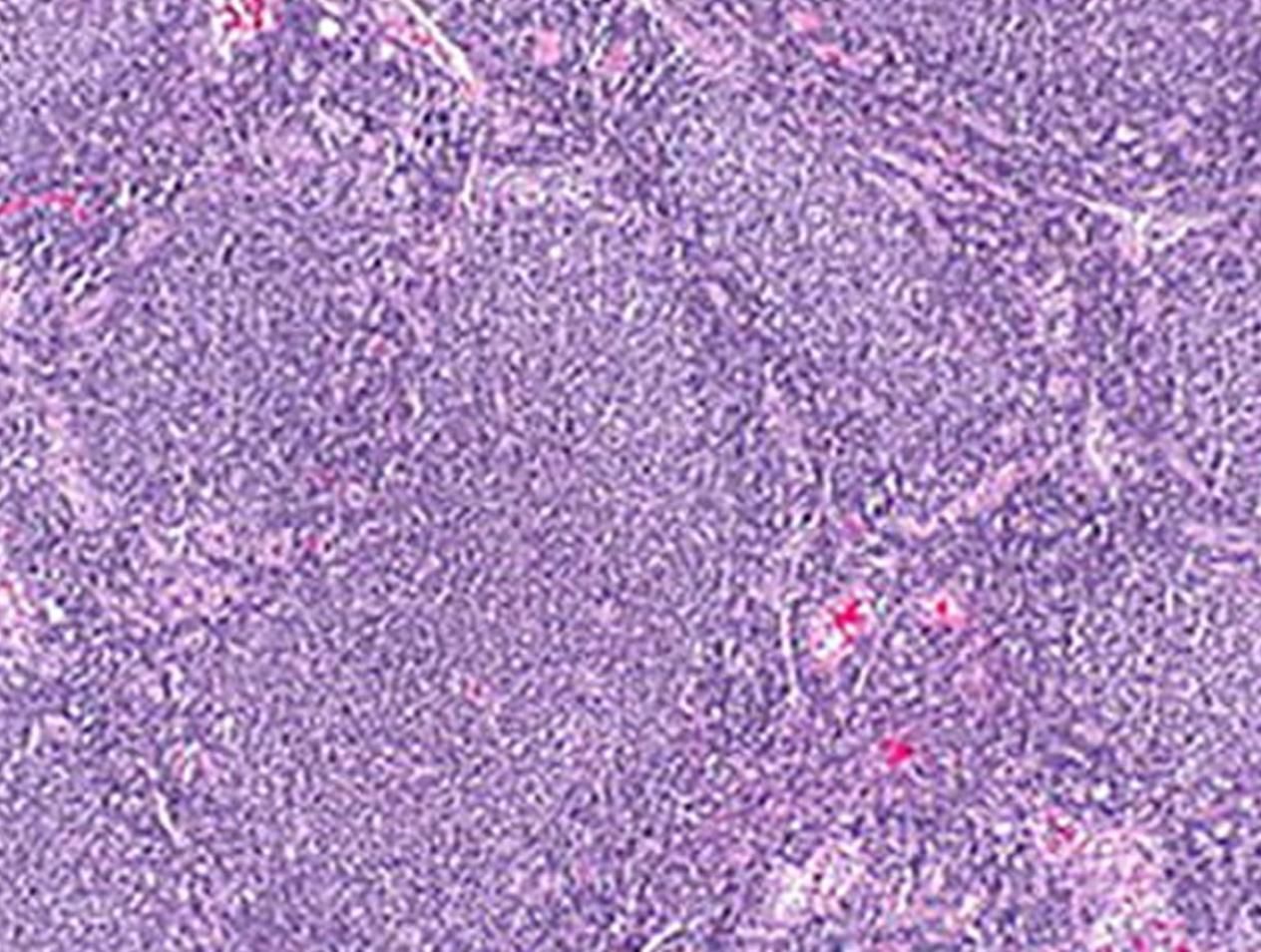 Hematopathology